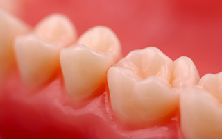 Closeup of tooth with dental fillings