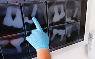 Digital dental x-rays on computer screen