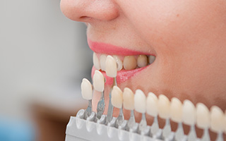 Woman's smile compared with tooth shade chart