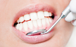 Closeup of healthy gums