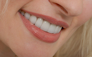 Closeup of healthy smile