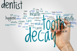 Tooth decay word cloud